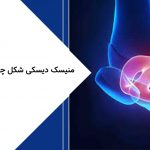 منیسک دیسکی شکل (discoid meniscus) چیست؟